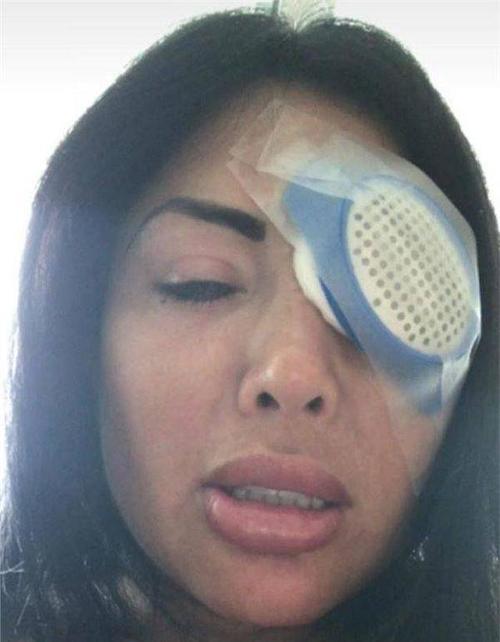 眼睛失明后如何操作手机拍照？