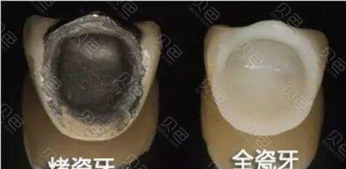 热水器晶硅内胆与陶瓷内胆的区别是什么？哪种更耐用？